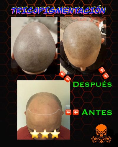 micropigmentacion-en-rivas-1