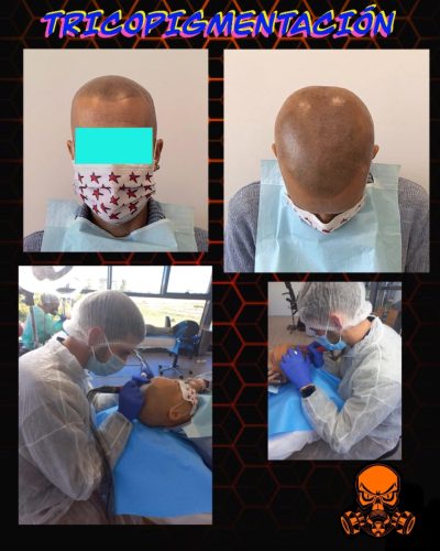 micropigmentacion-en-rivas-2