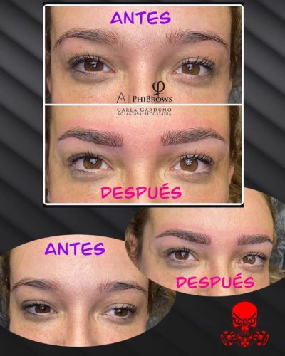 microblanding-rivas-jul-25